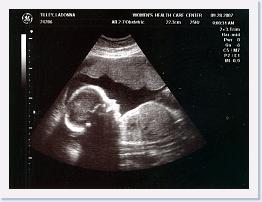 September - Sara Ultrasound - (3) * 1069 x 802 * (1.06MB)